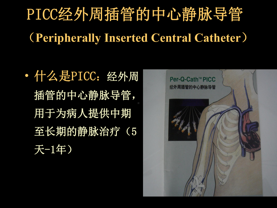 picc置管术及护理课件5.ppt_第2页