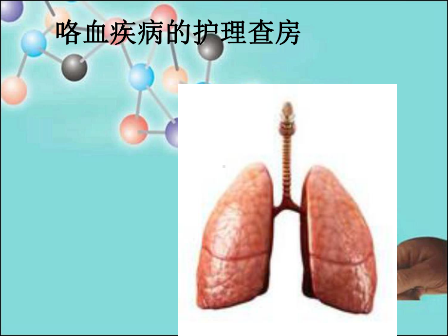 咯血疾病的护理查房课件.ppt_第1页