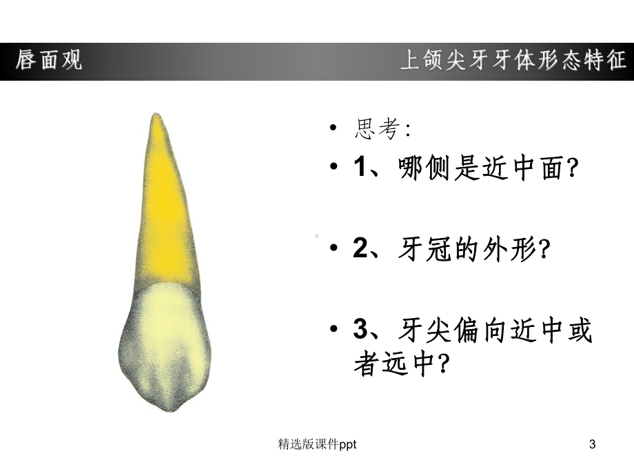 上颌尖牙牙体形态简述课件整理.ppt_第3页