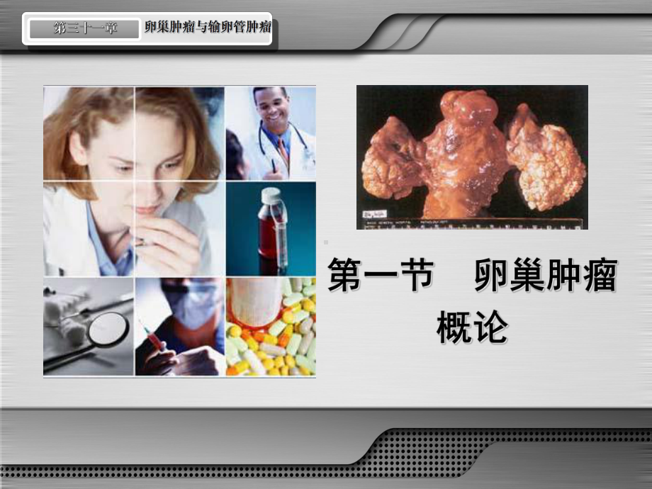 妇产科学卵巢肌瘤课件.ppt_第2页