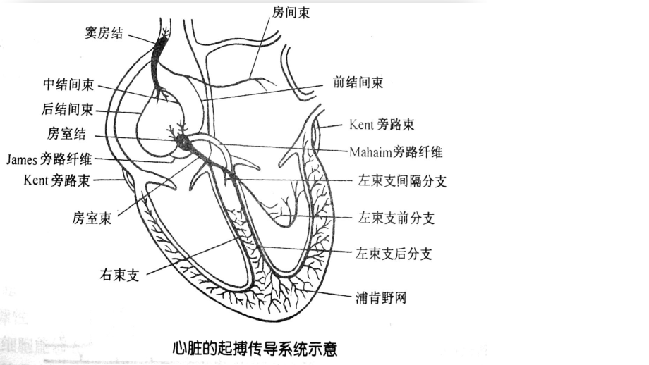 临时起搏器的护理9床课件.ppt_第3页