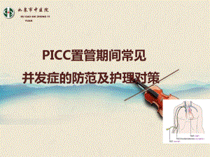 ICC置管期间并发症防范及护理对策课件.pptx