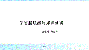 子宫腺肌症的超声诊断课件.ppt