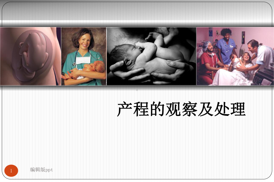 产程的观察及处理医学课件.ppt_第1页