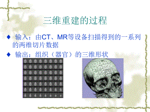 三维医学图像技术的意义课件.ppt