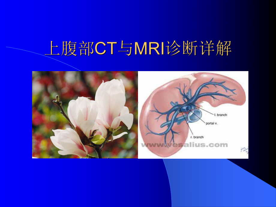 上腹部CT与MRI诊断详解课件.ppt_第1页