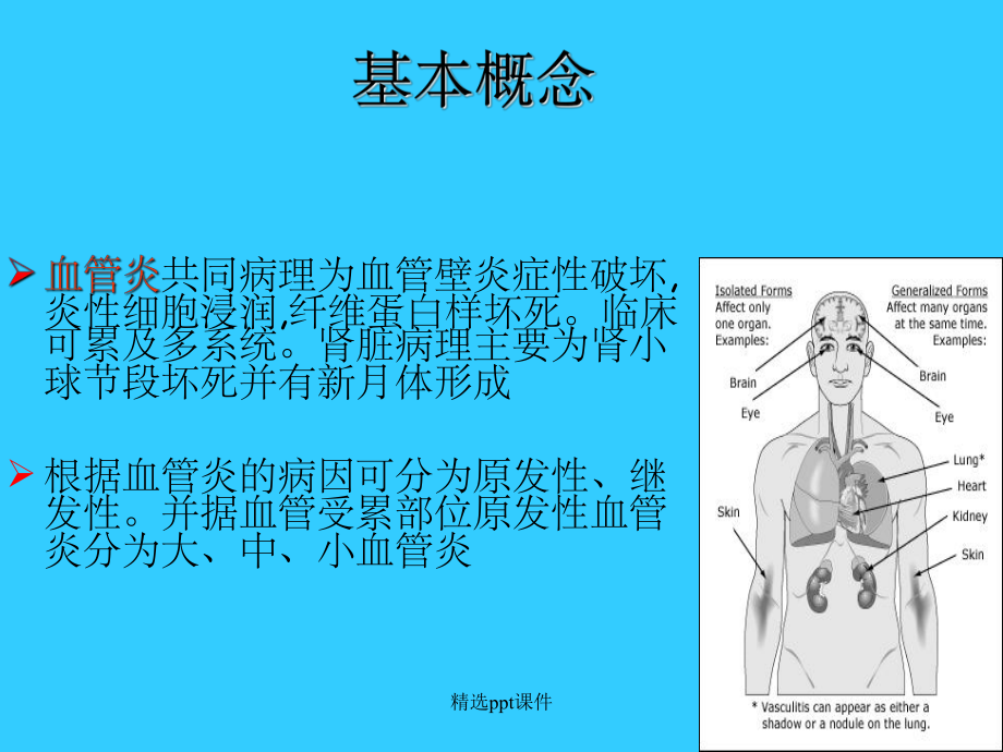 《原发性血管炎》课件.ppt_第2页