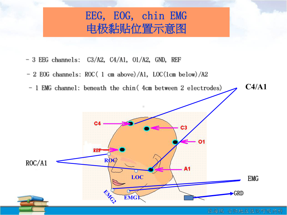 多频道生理纪录法在睡眠呼吸中止症的应用课件.ppt_第3页