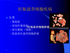 《妇产科学》课件.ppt