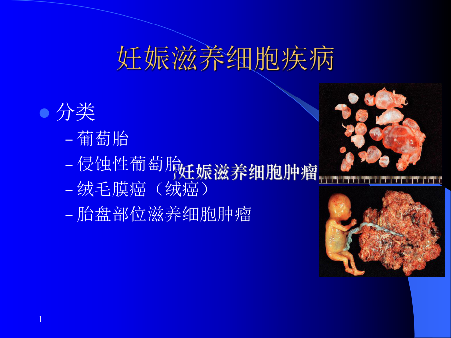 《妇产科学》课件.ppt_第1页