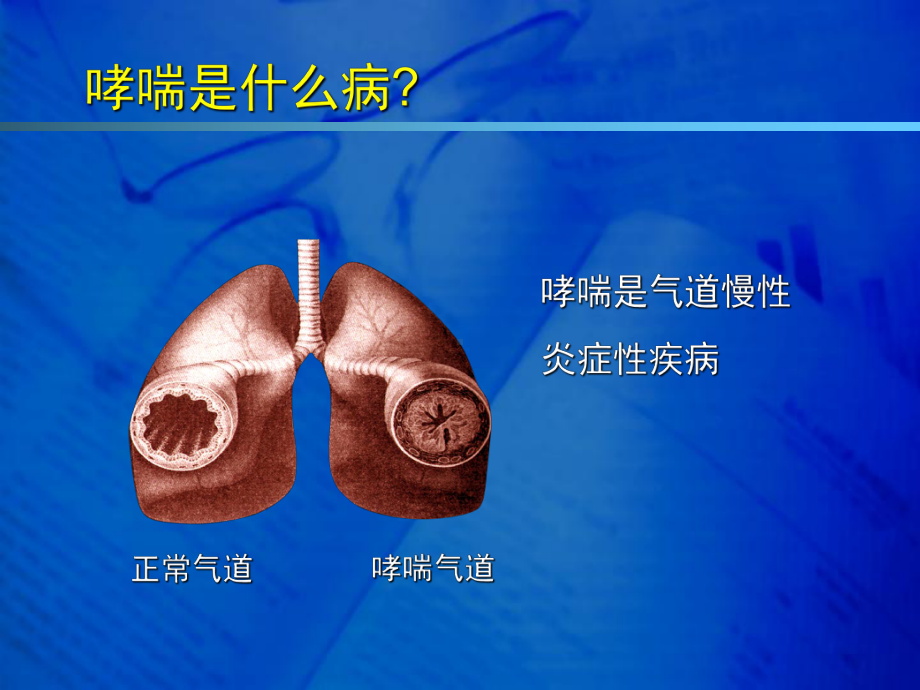 光力腾序贯治疗细菌性感染54例课件.ppt_第2页