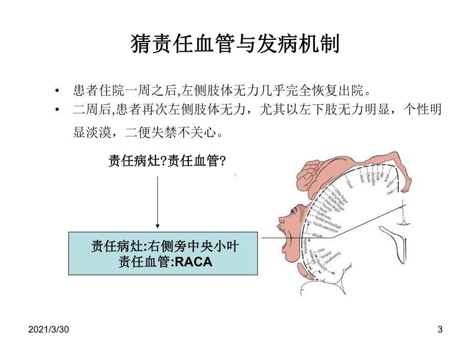 从影像学梗死部位推测责任血管和发病机制课件.ppt_第3页