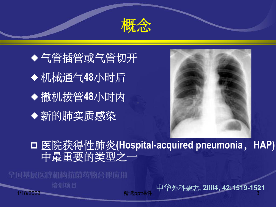 《呼吸机相关性肺炎》课件.ppt_第3页