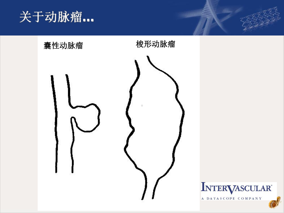 大血管胸主动脉手术课件.pptx_第3页