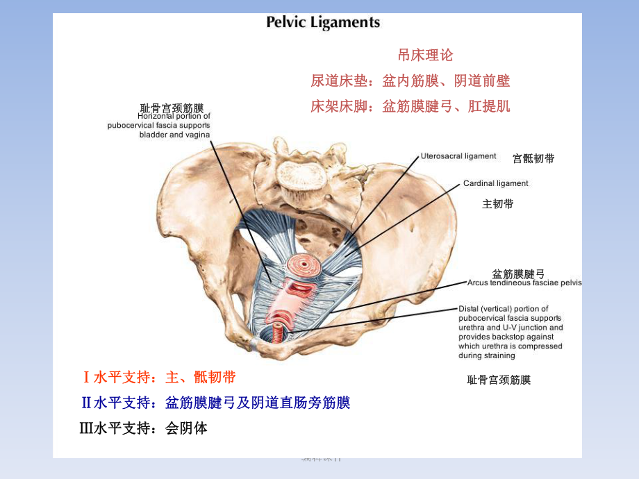 sling手术方式选择的思考课件.ppt_第2页