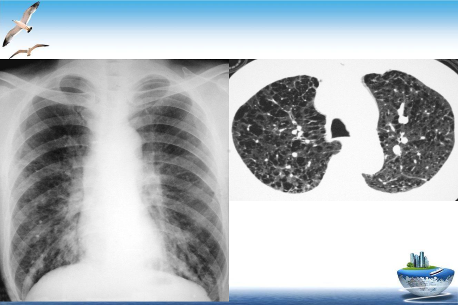医学影像诊断课件详解完整呼吸系统影像学优质课件.ppt_第2页