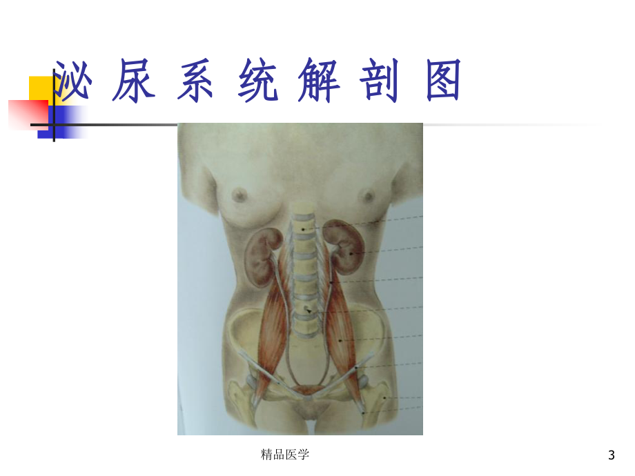 《尿石症病人的护理》课件.ppt_第3页