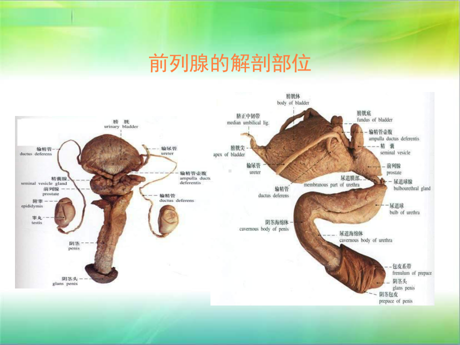 前列腺增生症课件整理.ppt_第3页