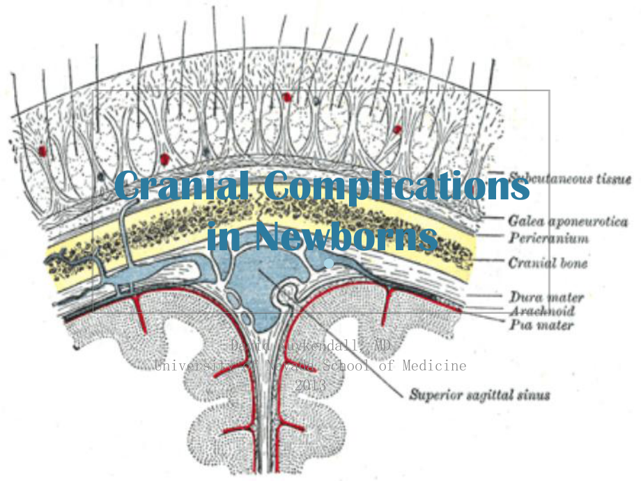 CranialComplicationsinNewborns：新生儿颅内并发症课件.ppt_第1页