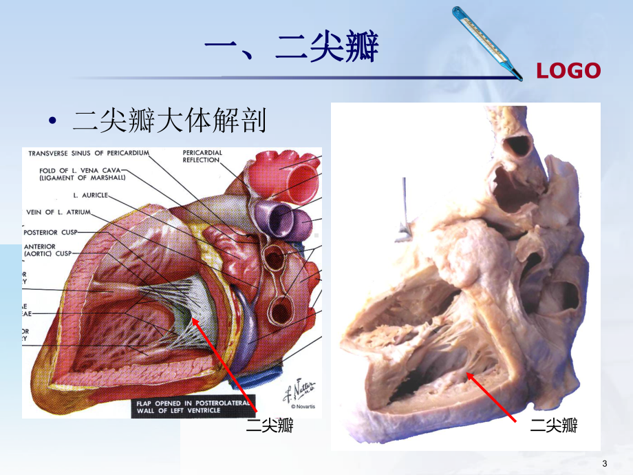 图解超声心动图评估瓣膜反流程度课件.ppt_第3页