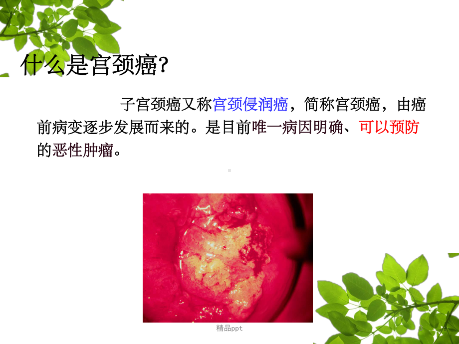 HPV感染与宫颈癌(同名459)课件.ppt_第3页