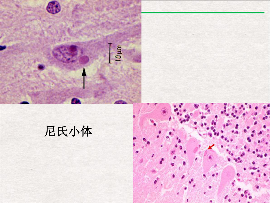 狂犬病诊治范例版课件.pptx_第3页