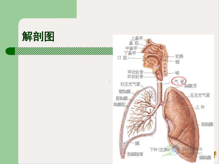 气管切开与气管插管术后护理课件.pptx_第3页