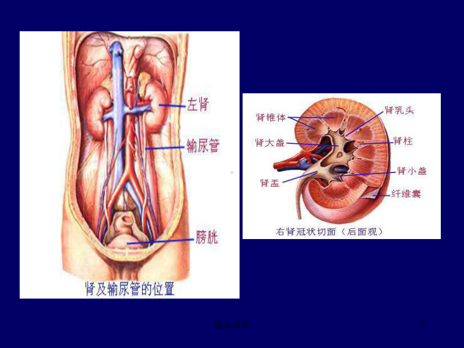 泌尿系统影像学表现课件.ppt_第2页