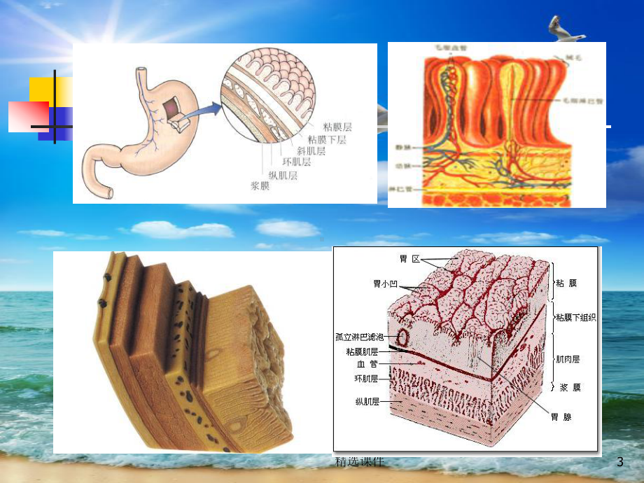 消化内镜治疗新技术课件.ppt_第3页