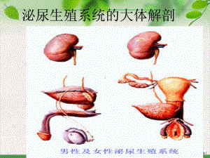 泌尿科手术病人的护理课件完整版.pptx