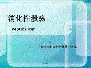 消化性溃疡课件(同名21).ppt