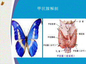 甲状腺癌根治术中喉返神经监测技术的应用课件.pptx