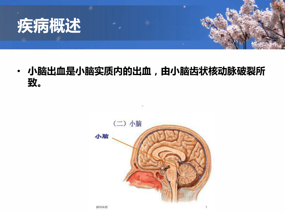 最新小脑出血护理查房演示教学课件.ppt_第3页