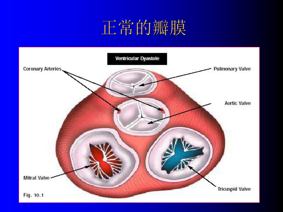 瓣膜性脏病课件.ppt_第3页