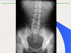 泌尿系X线检查方法及其正常表现课件.pptx