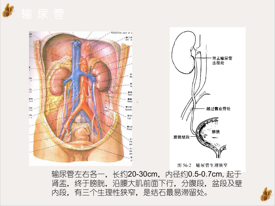 泌尿系结石的诊断及治疗课件.pptx_第3页