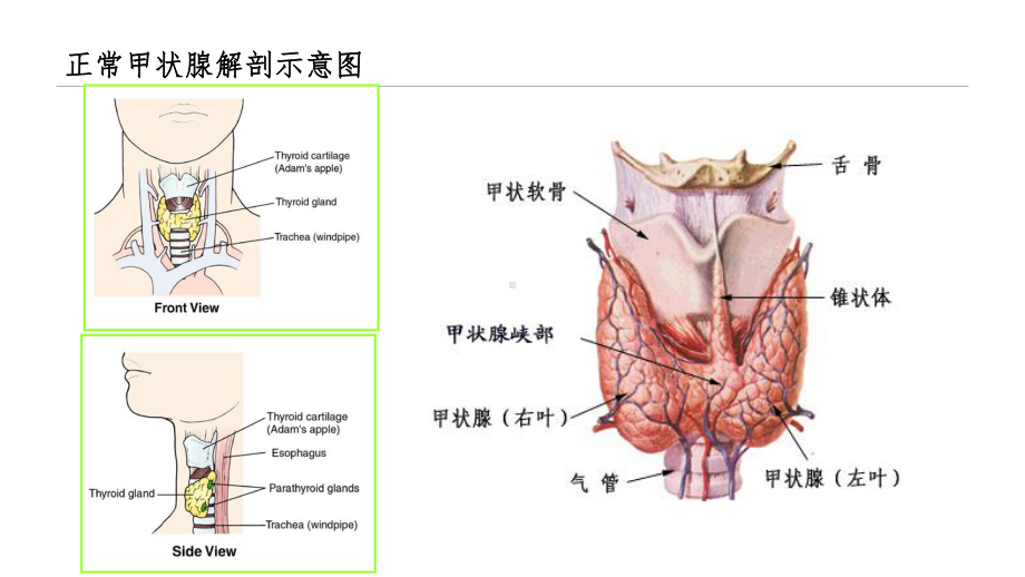 甲状腺毒症的诊治课件.ppt_第3页