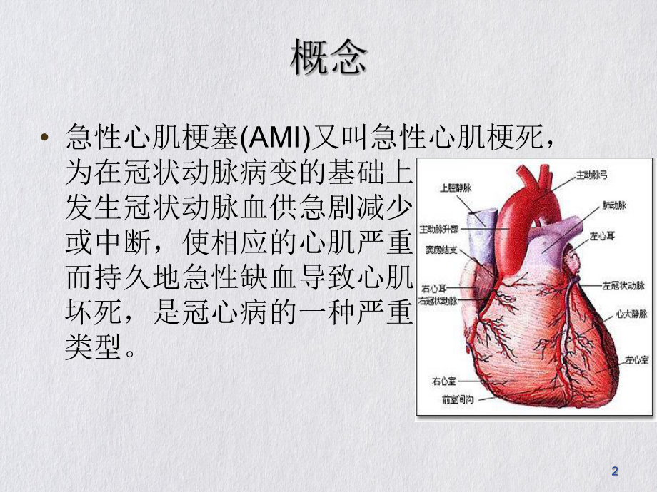 急性心肌梗死的护理措施优质课件.ppt_第2页