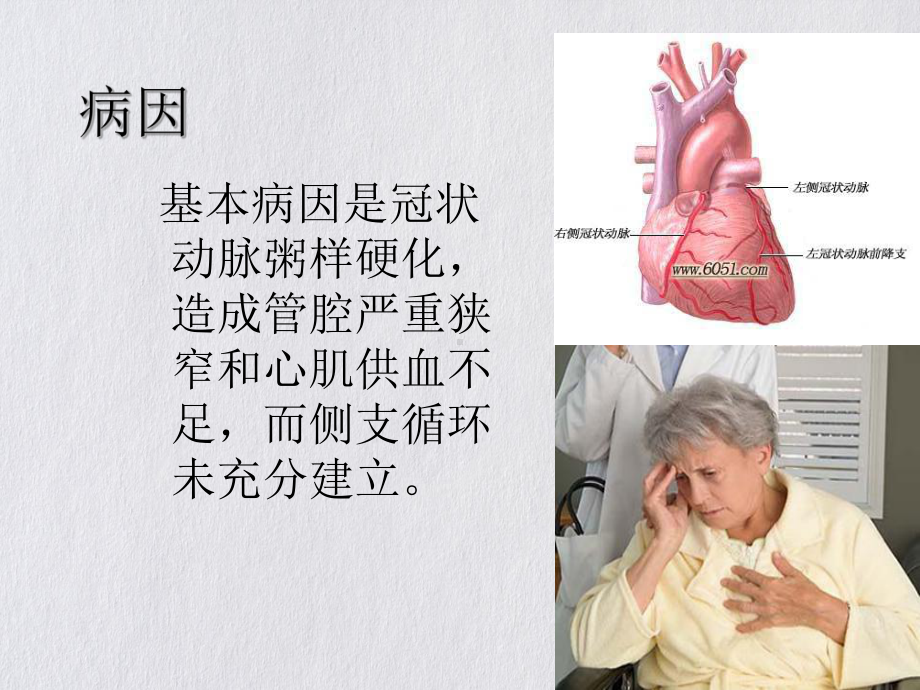 急性心肌梗死的护理措施优质课件.ppt_第3页