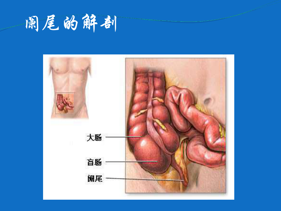 急性阑尾炎课件整理.ppt_第2页