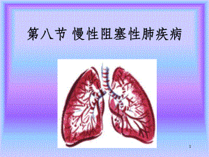 慢性阻塞性肺疾病课件(同名305).ppt