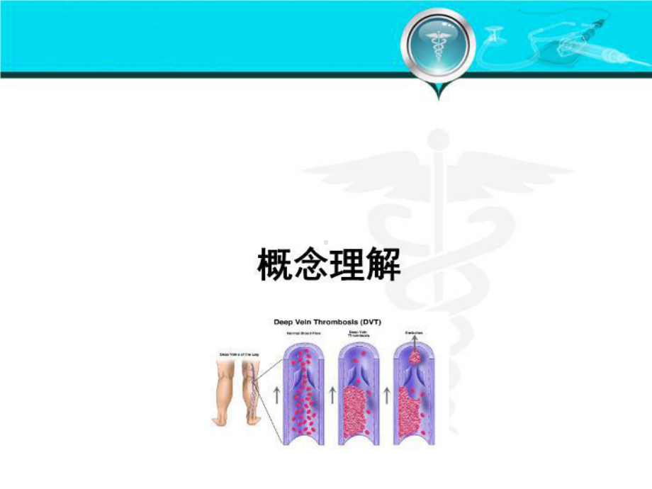 最新VTE的预防和治疗上课讲义课件.ppt_第3页