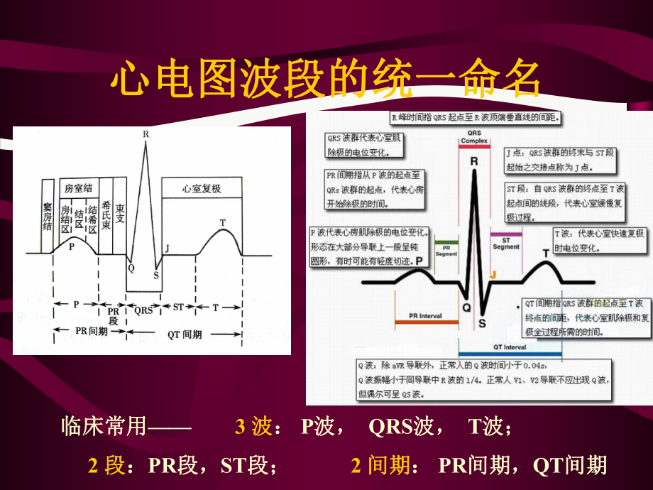 心电图心电向量与心肌缺血课件.pptx_第2页