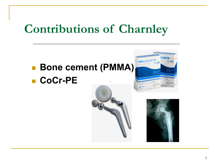 现代骨水泥技术在髋关节置换中的应用课件.ppt_第3页