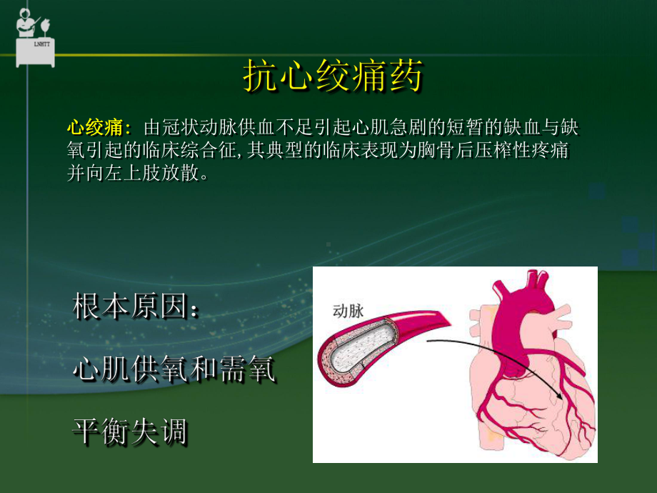 抗心肌缺血药介绍整理课件.ppt_第2页