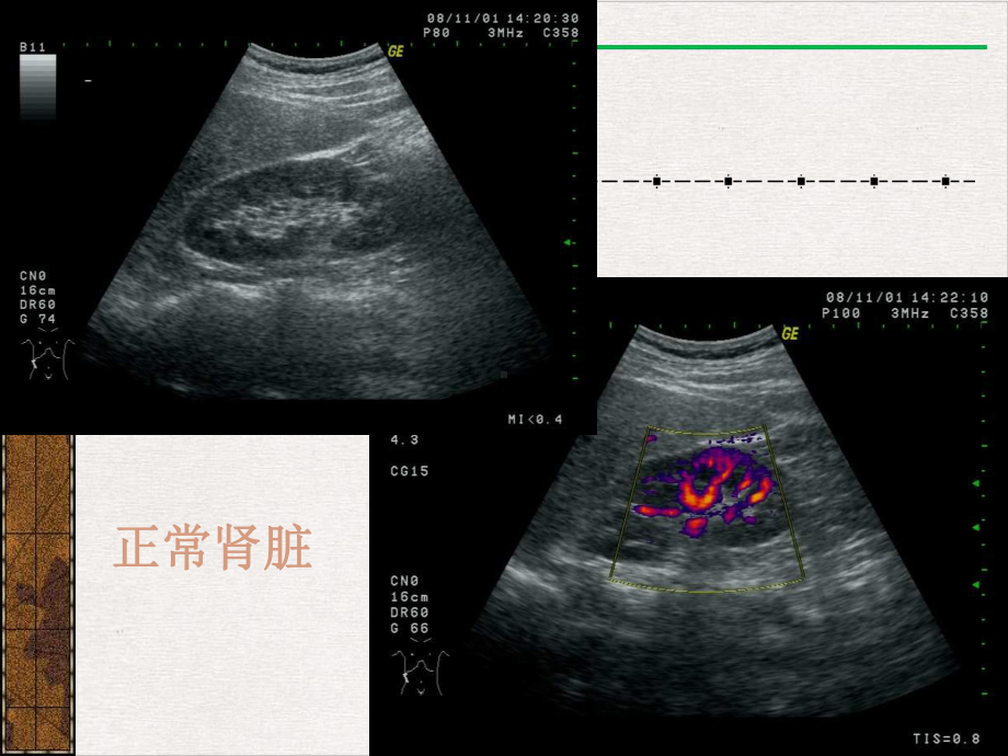 泌尿系统的超声诊断完美版课件.pptx_第3页