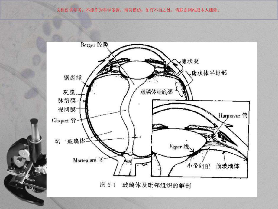 玻璃体积血专业知识讲座课件.ppt_第2页