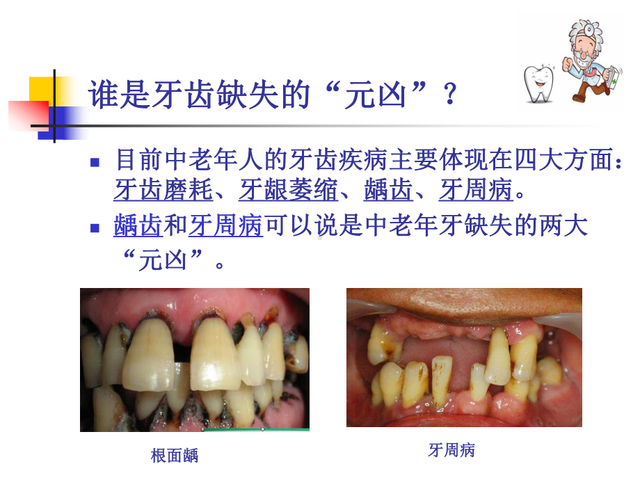 最新口腔科-中老某年科普知识讲座讲课讲稿课件.ppt_第3页