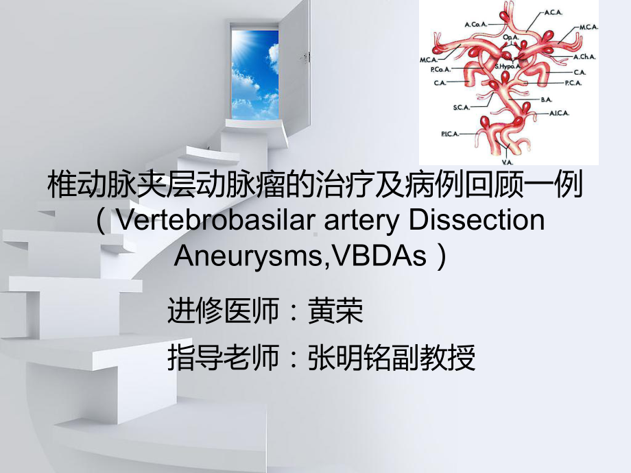 椎动脉夹层动脉瘤的治疗与病例复习一例课件.ppt_第1页