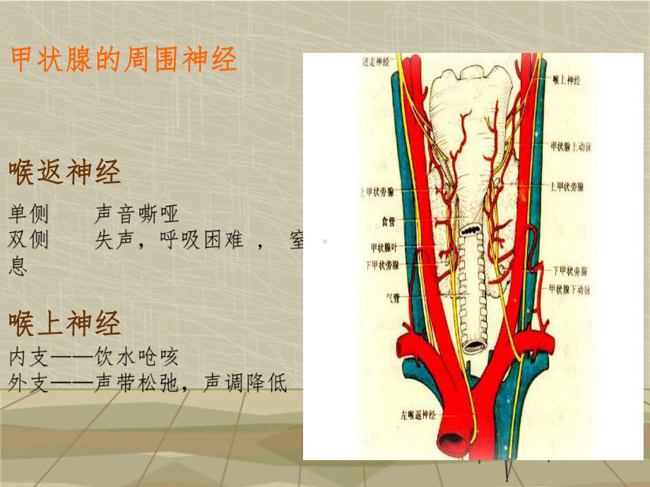 甲状腺肿瘤护理查房(同名1237)课件.ppt_第3页